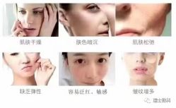 -安吉拉青春化管理中心