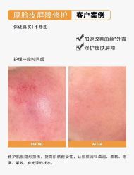 -佳慕·痘痘·问题肌管理中心