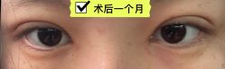 -JustHer宁波珈禾医疗美容医院