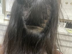 点击看大图 -熙朵美学植发连锁