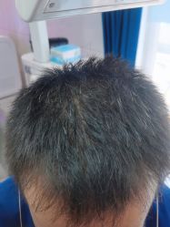 -雍禾植发全国连锁