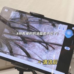 -润复丝·泽发防脱头皮管理