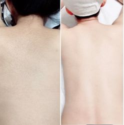 -薇兰专业脱毛连锁机构