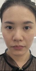 -一美医疗美容