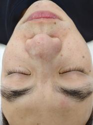 -蕾特恩专业祛痘·皮肤管理