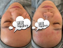 -skin79皮肤管理中心