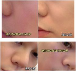 -南宁华美医疗美容医院