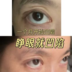 -丰联丽格医疗美容·联合丽格眼整形中心