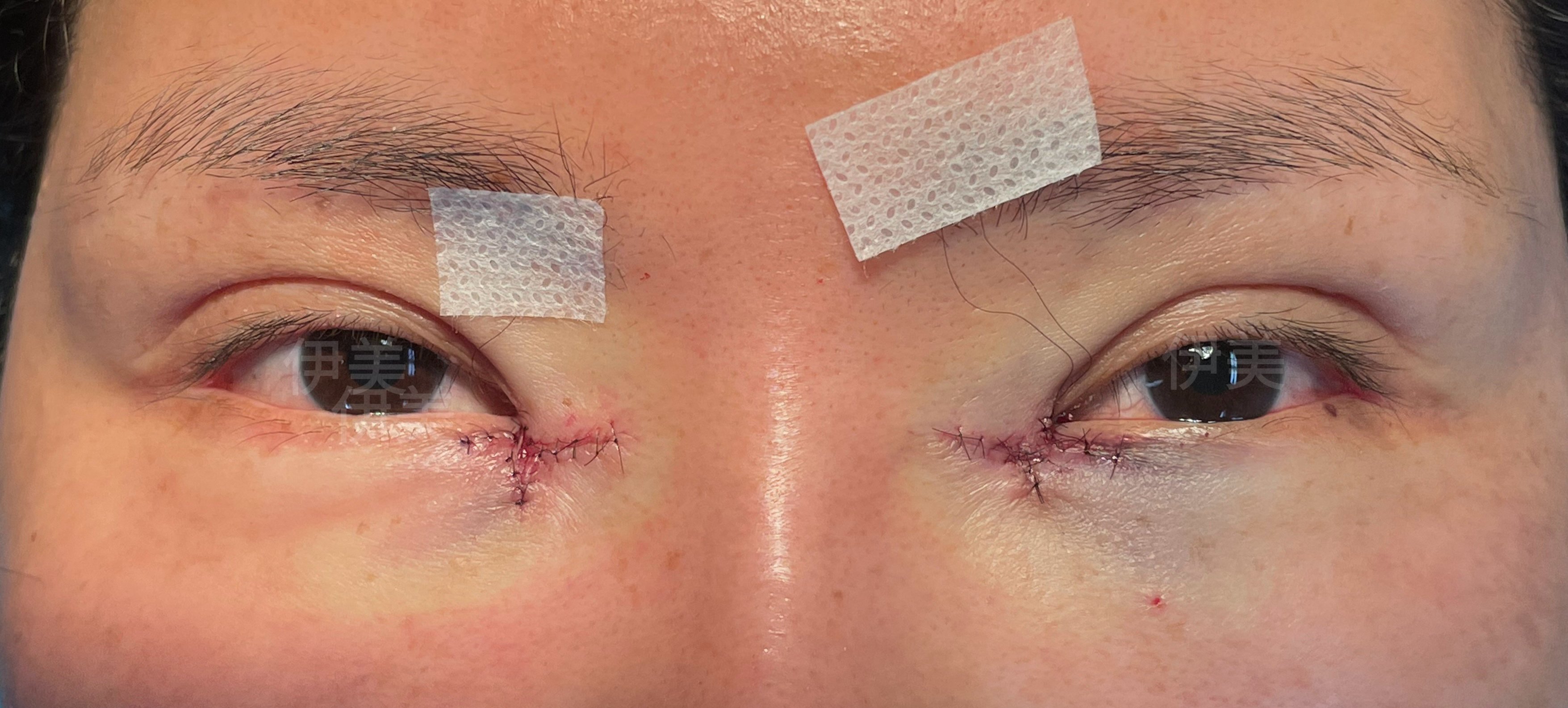 6.26【回包眼角】体验当天效果