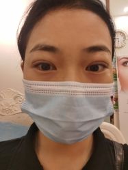 体验后-紫洁俪方（北京）医疗美容