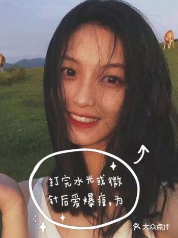 打完水光或微针后爱爆痘，为森么？