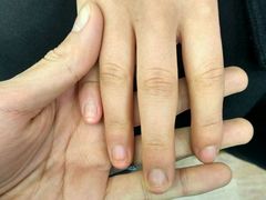 -Andrew指甲专科灰指甲·甲沟炎矫正·3D步态矫形鞋垫定制(上海法华镇路旗舰店)
