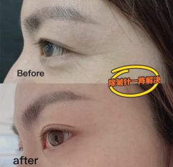 -上海漾颜医疗美容