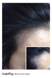 点击看大图 纹绣-光SPA科技美肤