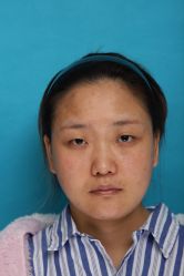 -四川米兰柏羽医学美容医院
