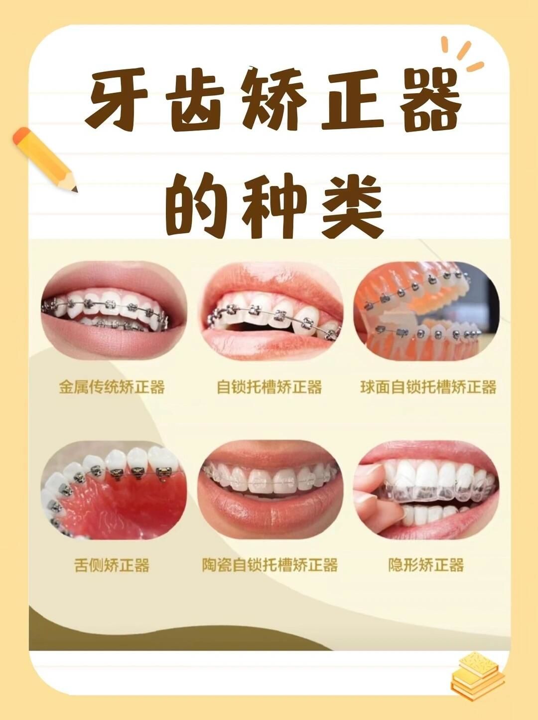 牙齿健康,各种形式的托槽