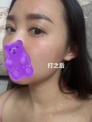 -Yestar宁波艺星整形医院
