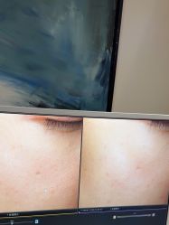 -苑苑vbeauty科技美容SPA