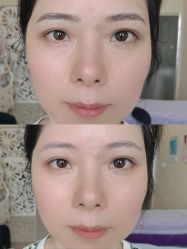 点击看大图 -西施无菌半永久纹绣眉眼影唇轻增发纹发际线