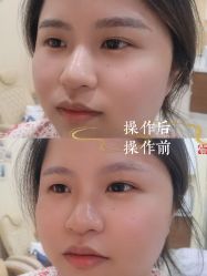 -西施无菌半永久纹绣眉眼影唇轻增发纹发际线