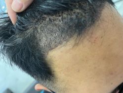 -雍禾植发全国连锁