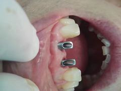 -泰康拜博口腔(柠溪门诊)