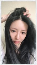 -大麦微针植发全国连锁