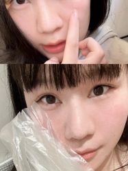 点击看大图 体验前-深圳阳光医疗美容