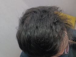 -熙朵美学植发·连锁品牌