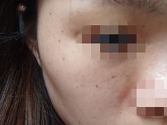 -重庆医科大学附属第一医院(本部)