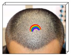 -大麦微针植发全国连锁