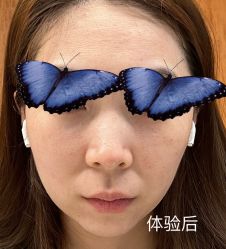 体验后-原力医疗美容