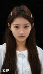 -Yestar重庆艺星医疗美容医院