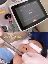 -和颜一美轻医美连锁