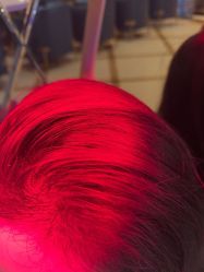 -碧莲盛·不剃发植发