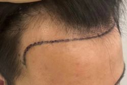 -熙朵美学植发·连锁品牌