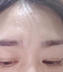 体验后-北京炫美医疗美容