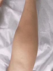 -楚沅先生专业男士脱毛连锁