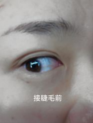 体验前-LEYA皮肤管理