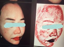 -和颜一美轻医美连锁