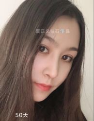 -北京米扬丽格医疗美容·联合丽格鼻整形中心