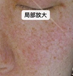 点击看大图 -睿明真达专业皮肤护理中心