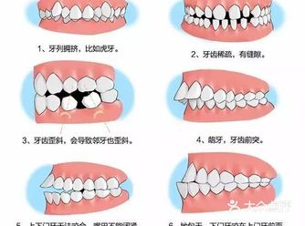 口腔正畸通俗的讲，就是将不整齐的牙齿排列整齐