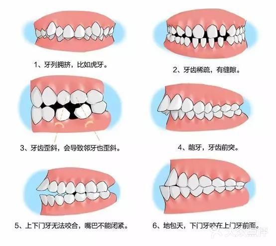 什么是口腔正畸？