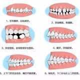 什么是口腔正畸？