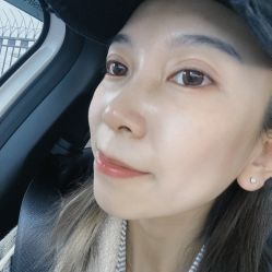 体验后-坤如玛丽·医疗美容中心
