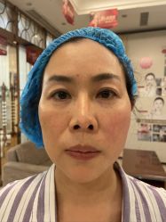 体验前-大华韩艺整形美容医院