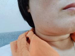 -痣清宫祛斑祛痣连锁店