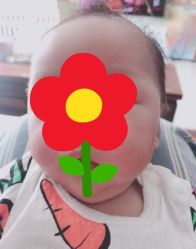 -碧莲盛·不剃发植发