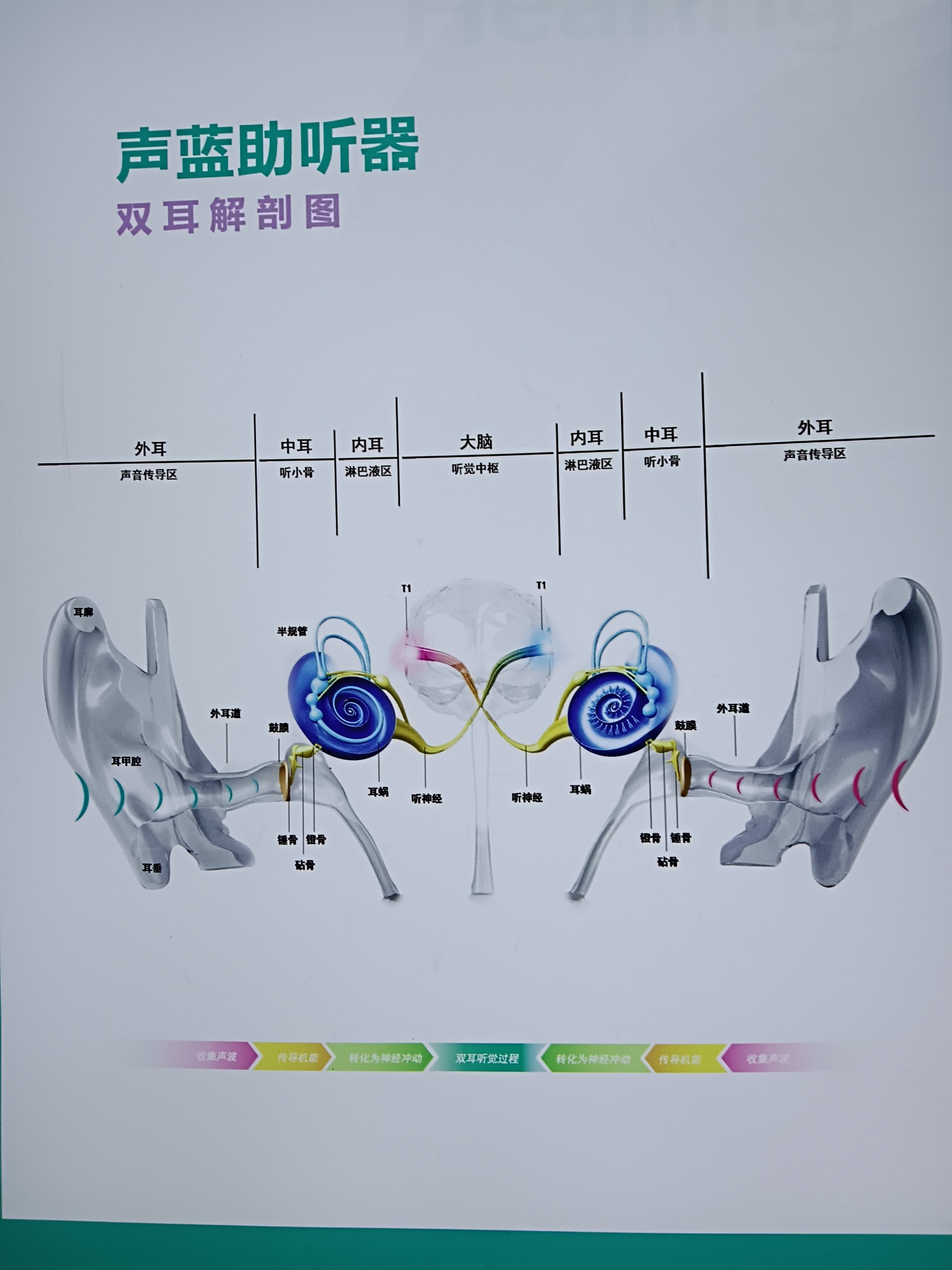 助听器内部结构图图片